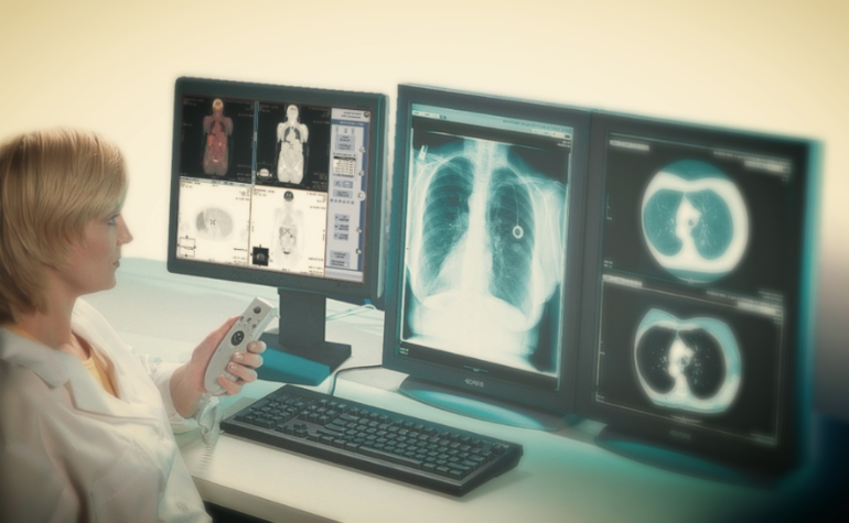 sovremennoe-sostyanie-rentgenografii